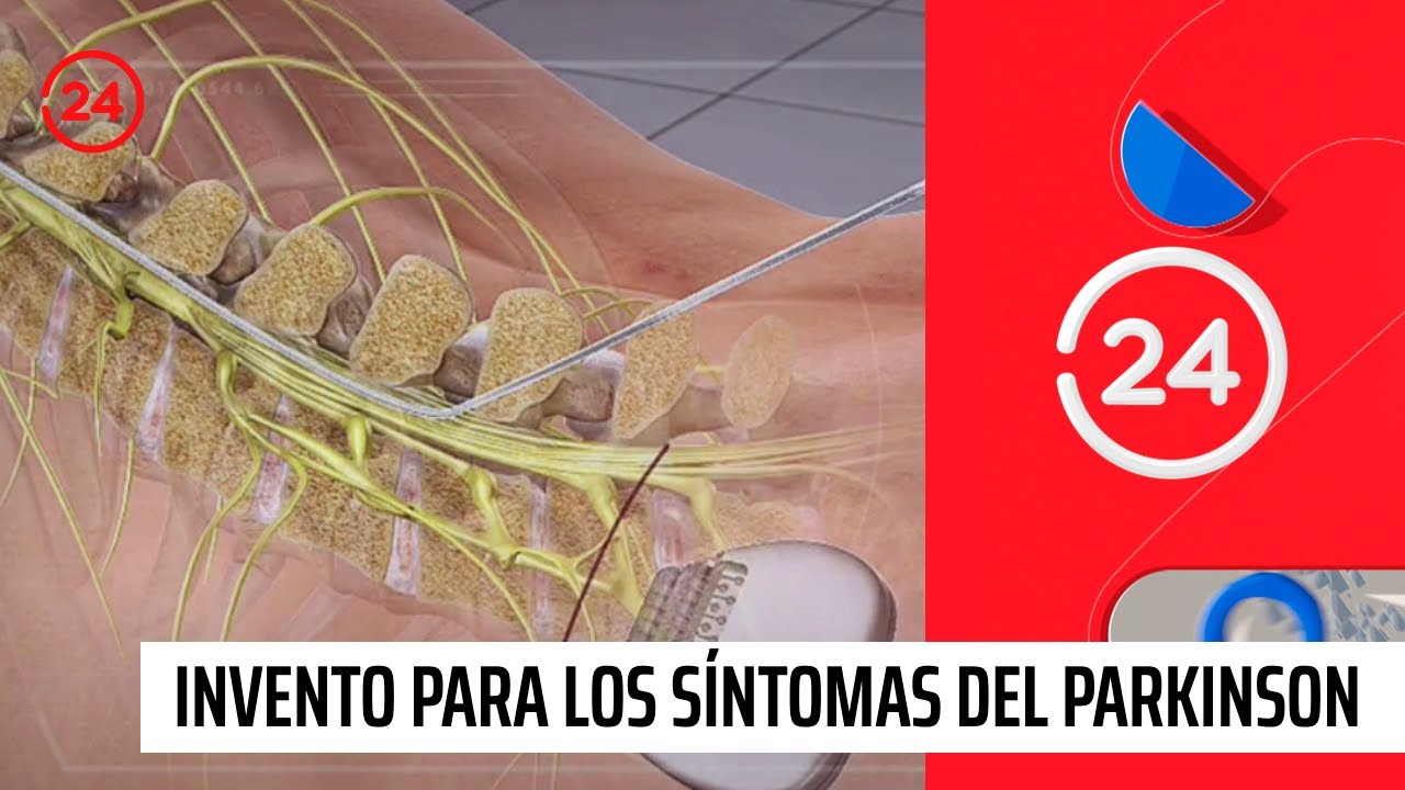 Revolucionario invento contra el Parkinson mejora movilidad de pacientes | 24 Horas TVN Chile