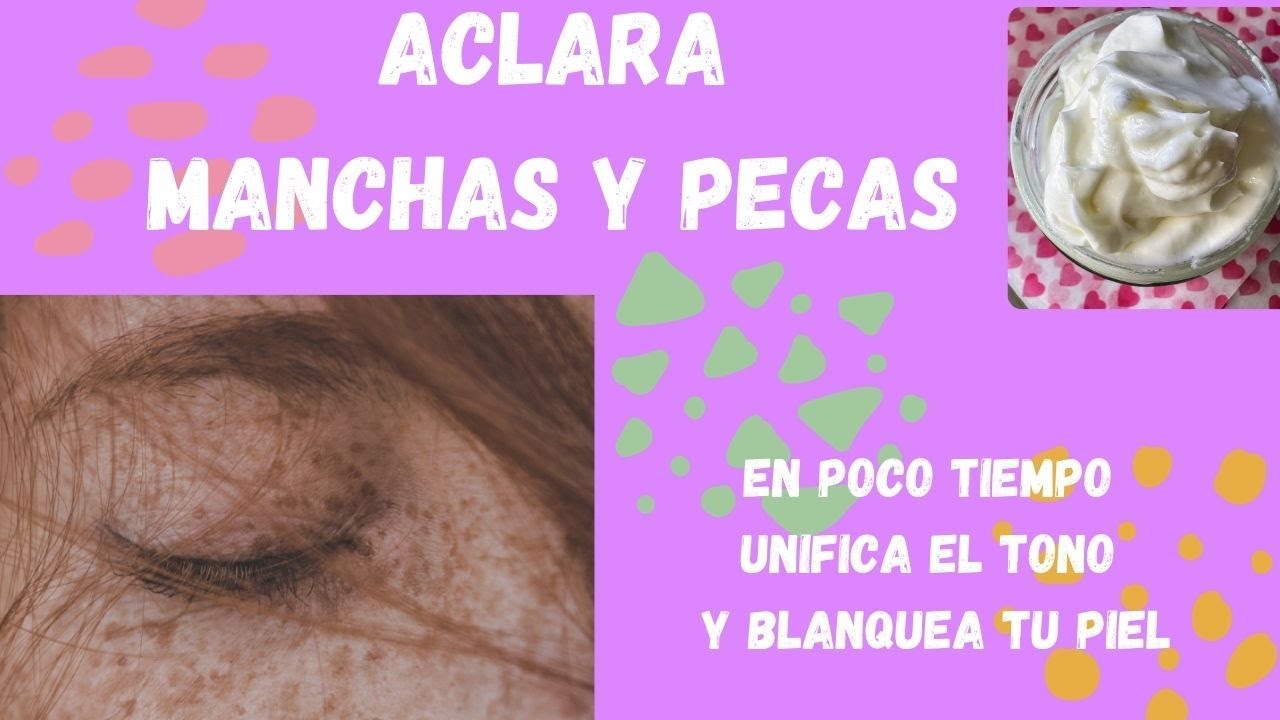 ACLARA MANCHAS Y PECAS con esta crema NATURAL. Cosmética Natural Casera.