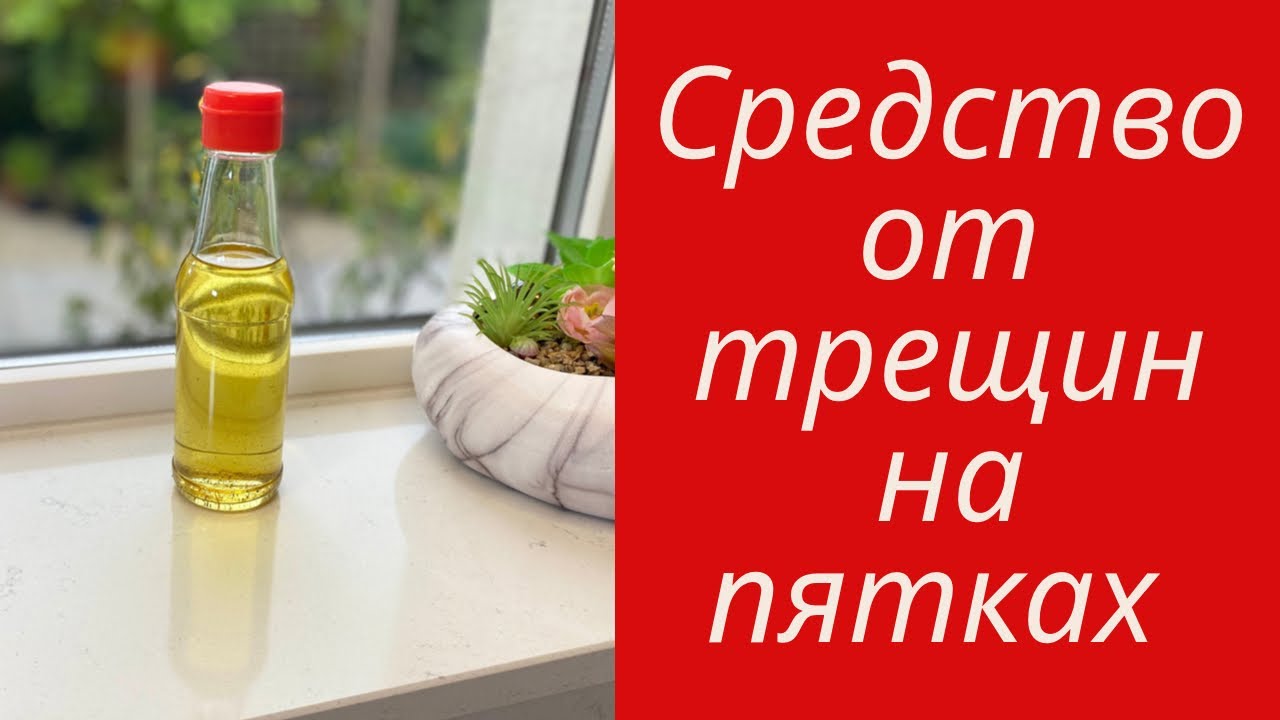 ВЫ БУДЕТЕ ВСПОМИНАТЬ МЕНЯ ДОБРЫМ СЛОВОМ! 🌺 КОПЕЕЧНОЕ СРЕДСТВО ИЗ 2х ИНГРЕДИЕНТОВ 🌺@Amond