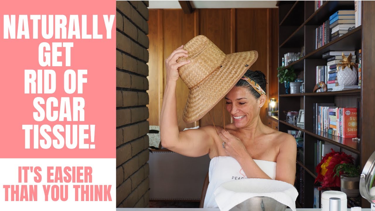 Get Rid of Scars, Dark Spots, & Melasma NATURALLY! | How to Reduce Scar Tissue Easily & At Home!