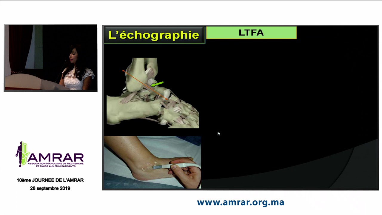 AMRAR - Exploration par imagerie des ligaments latéraux de la cheville - Siham TIZNITI 1/2 - 280919