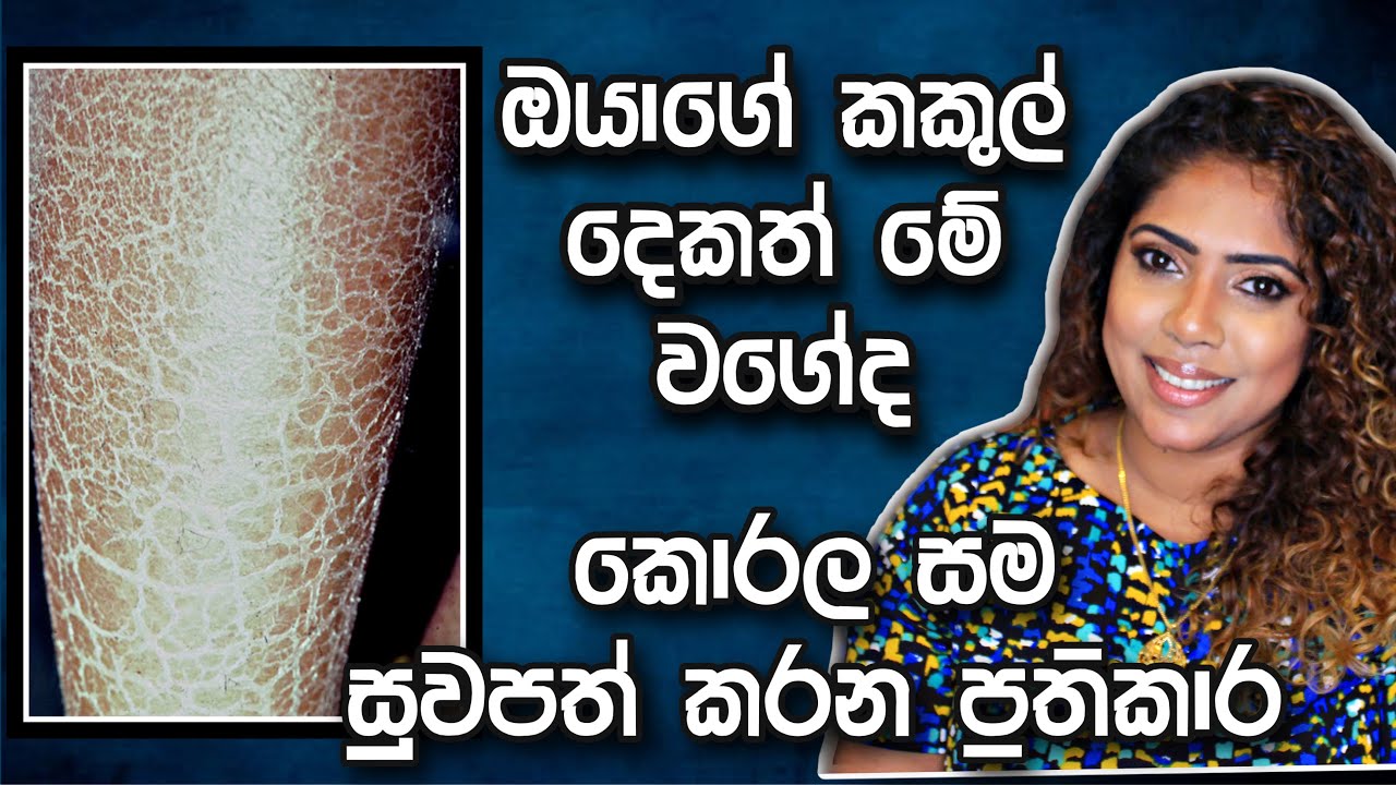 කොරල සමට ප්‍රතිකාර / Dehydrated Scally Skin Treatments