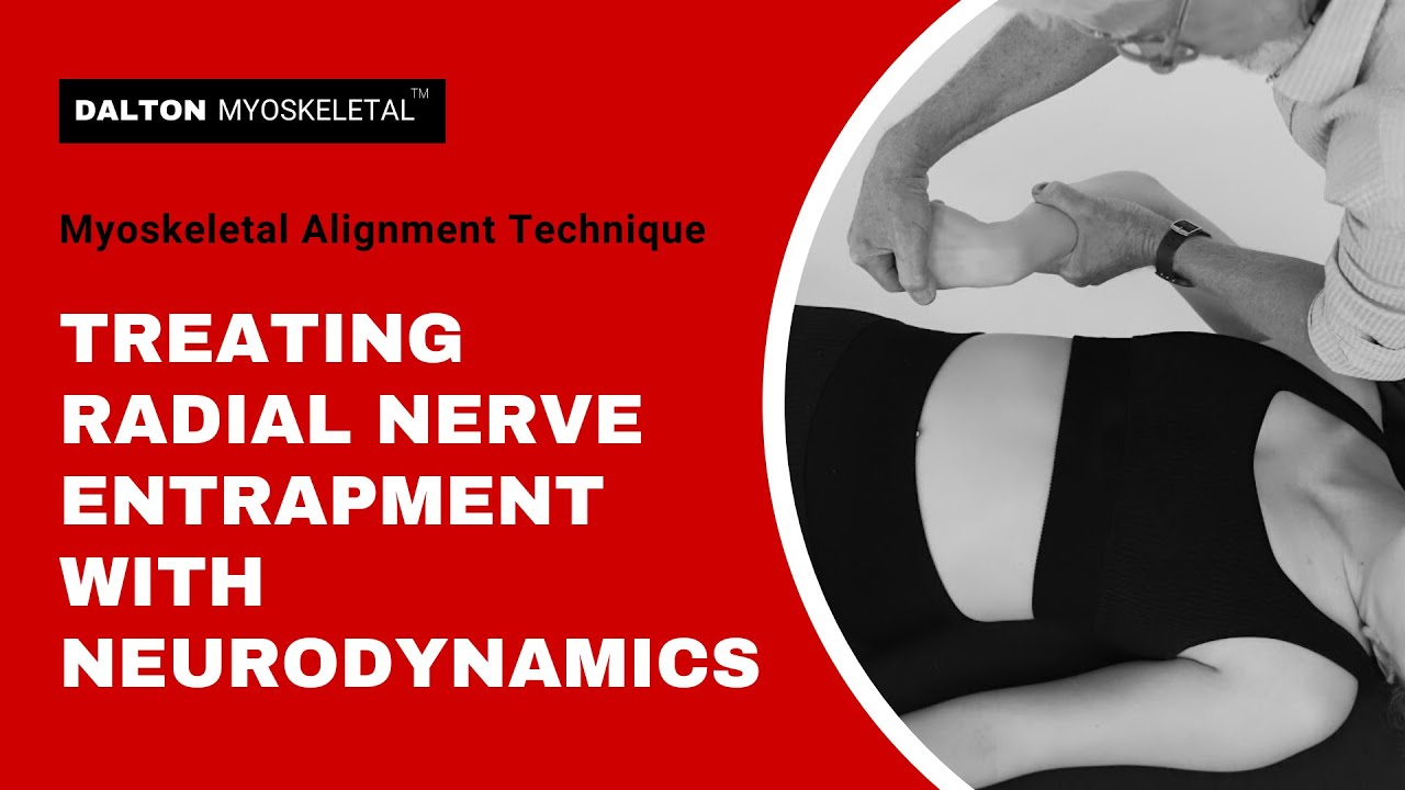 Free Yourself from Radial Nerve Entrapment with Neurodynamics! | ErikDalton.com
