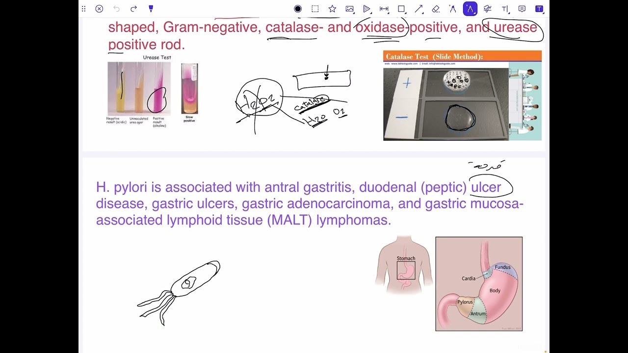 شرح بكتريا تحليلات المرحلى الثانية محاضرة  Helicobacter pylori 9.  اقرأ الوصف👇