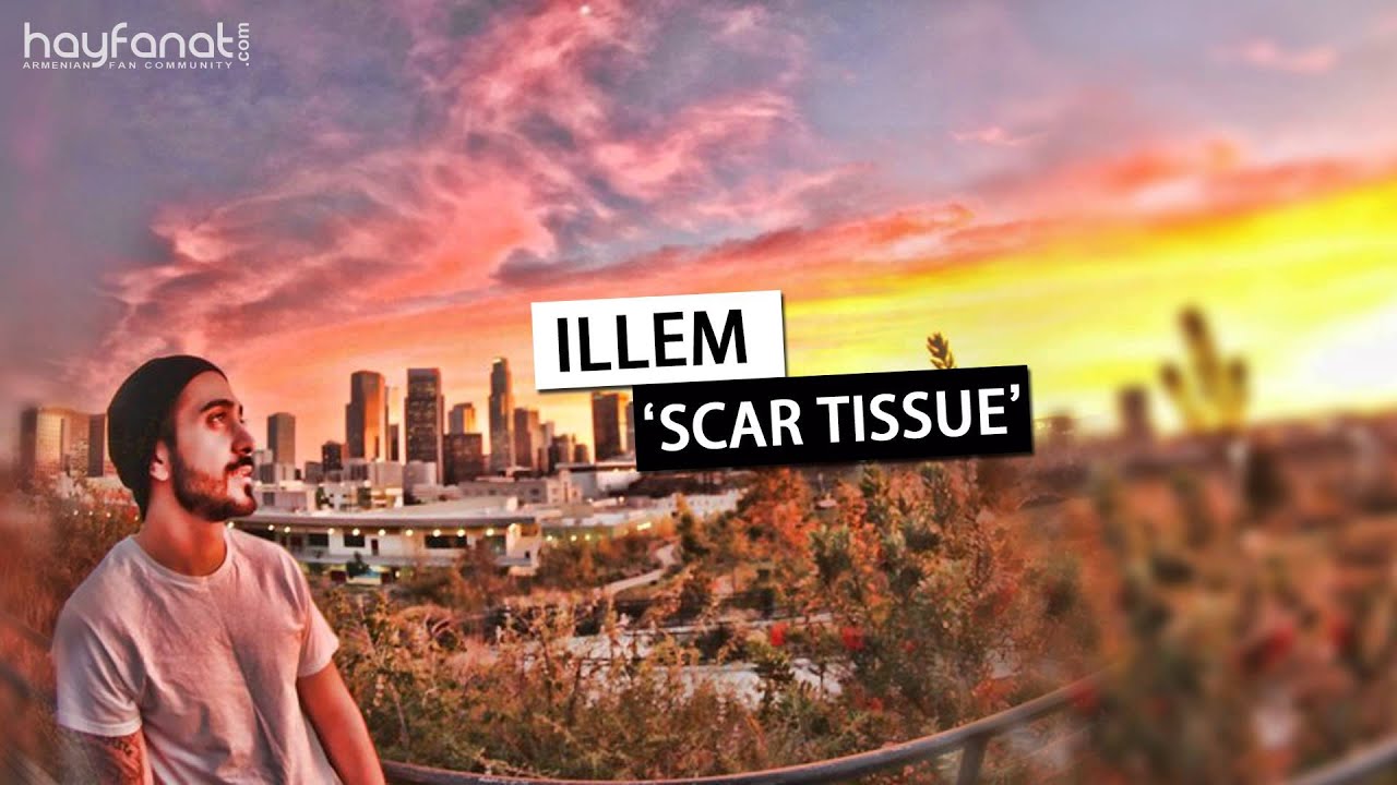 Illem - Scar Tissue (They Change) (Audio) // Armenian Rap // HF New // HD