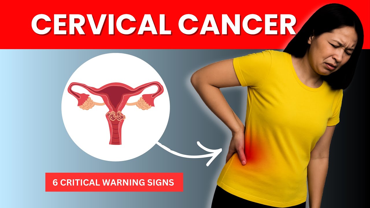 6 Symptoms of CERVICAL CANCER You should NEVER IGNORE