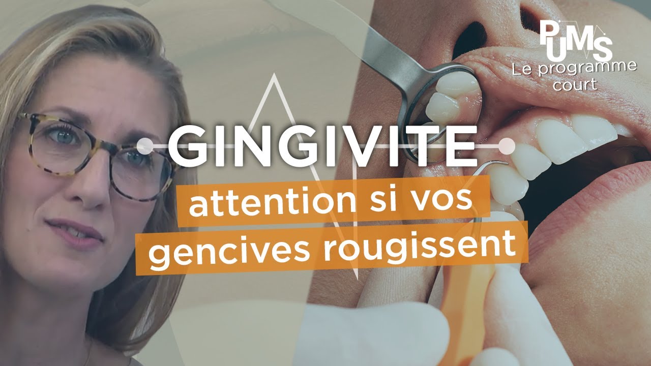 Gingivite : comment l’éviter et la soigner pour une meilleure santé ?