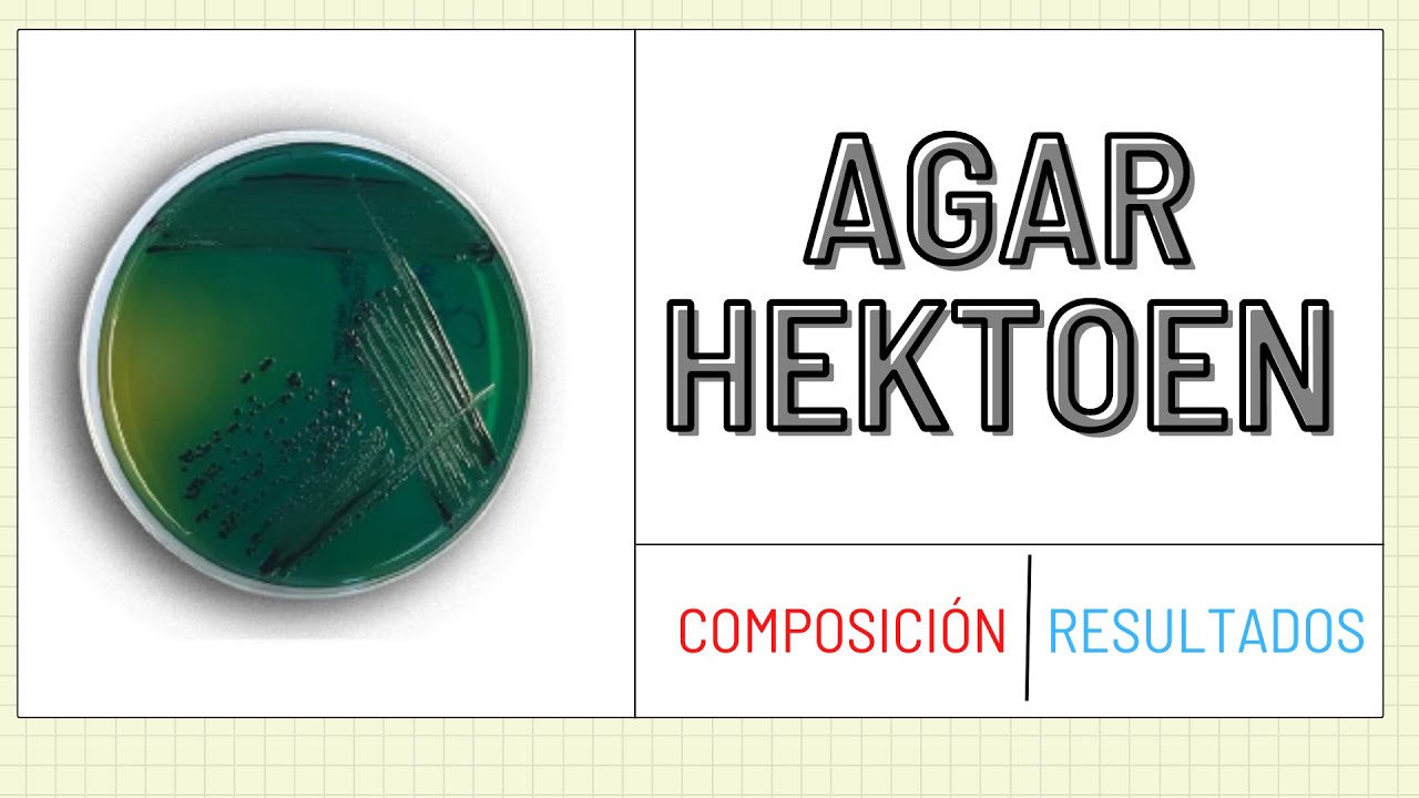 Agar HEKTOEN l HEKTOEN ENTERIC AGAR l AGAR HEKTOEN COMPOSICIÓN Y RESULTADOS l #Mediosdecultivo