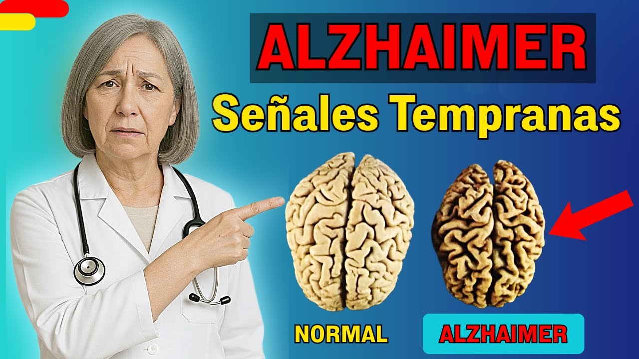 Alzheimer temprano: Las 5 señales que nadie ve venir