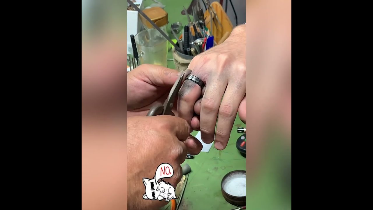 Cutting off a titanium ring. (Stuck) قطع خاتم من التيتانيوم. (عالق)