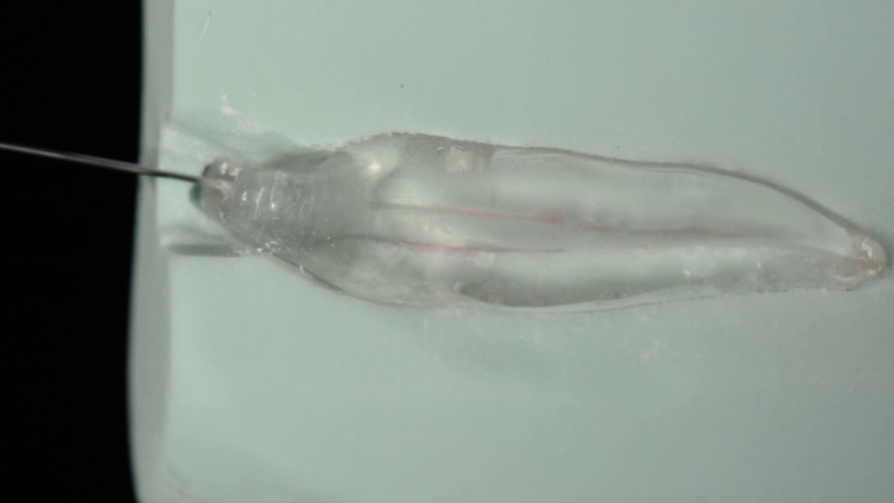 Endodontic coronal preparation: Gates