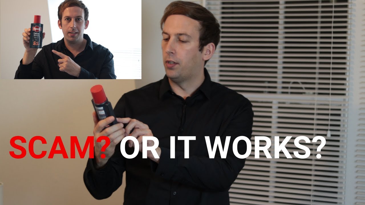 Does Alpecin Shampoo Help Hair Growth If You Are: BALDING, RECEDING, LOSING YOUR HAIR! HONEST REVIEW