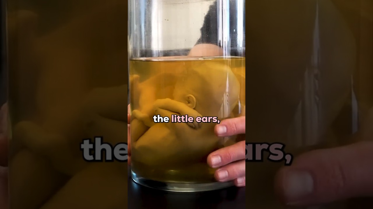 The Smallest Donated Body in Our Lab