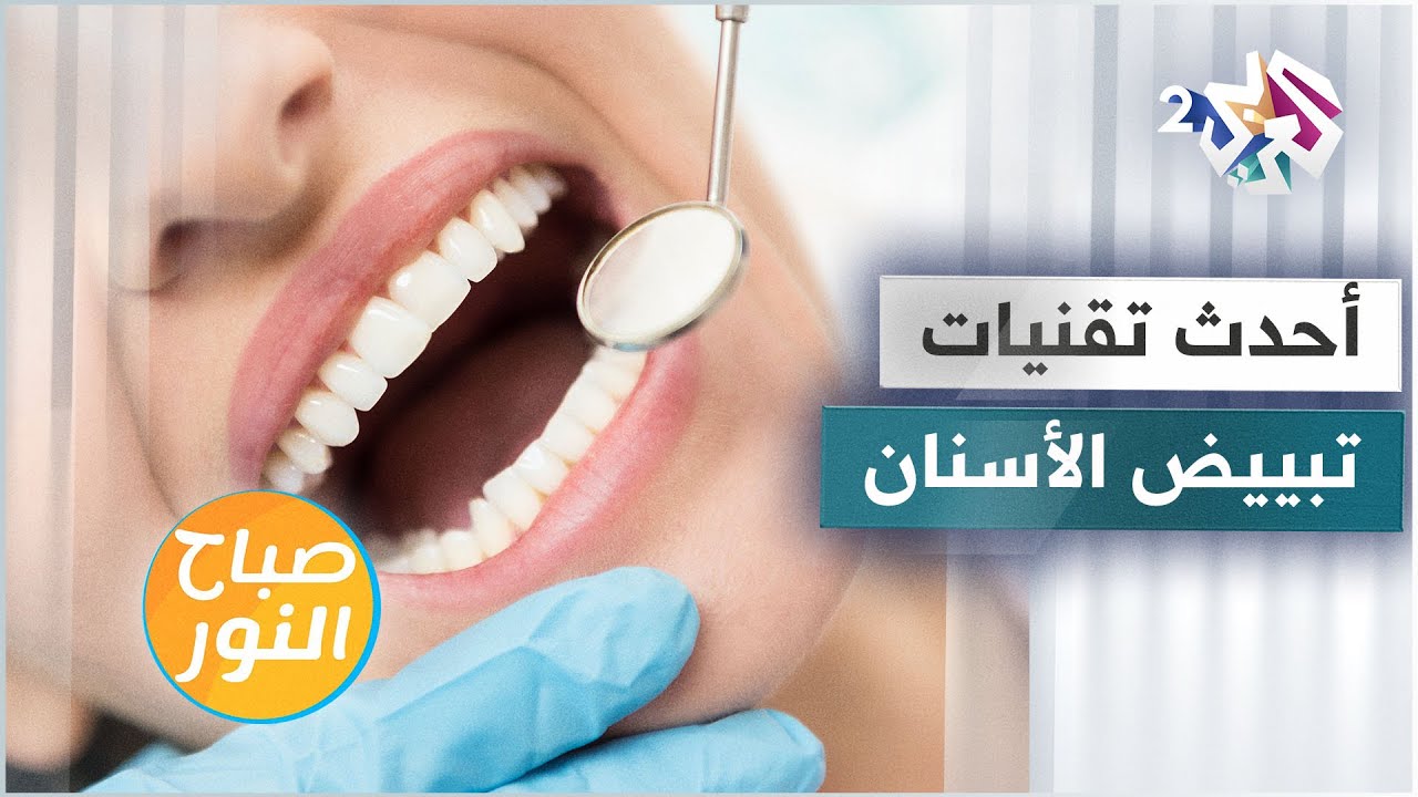 أحدث تقنيات تبييض الأسنان .. كيف نختار الأنسب لنا؟