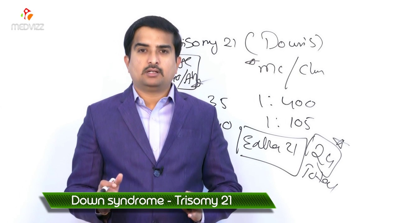 Trisomy 21 - Down's syndrome ( New )