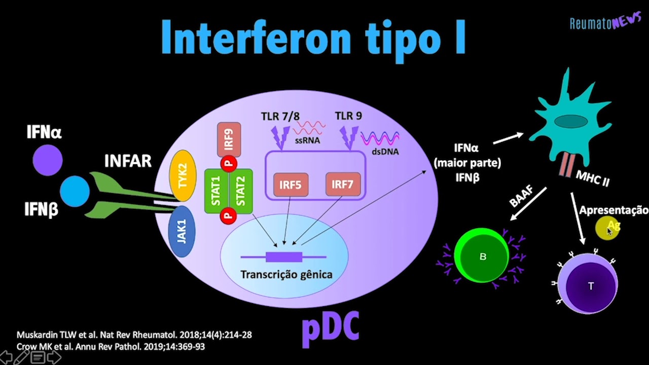 Interferon tipo I & Doen&ccedil;as reum&aacute;ticas imunomediadas