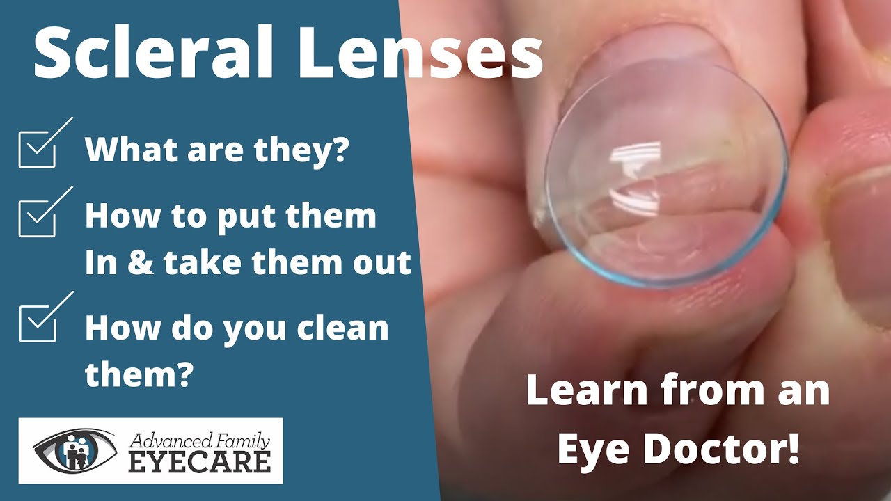 Scleral Lenses: What They Are & How to Use Them