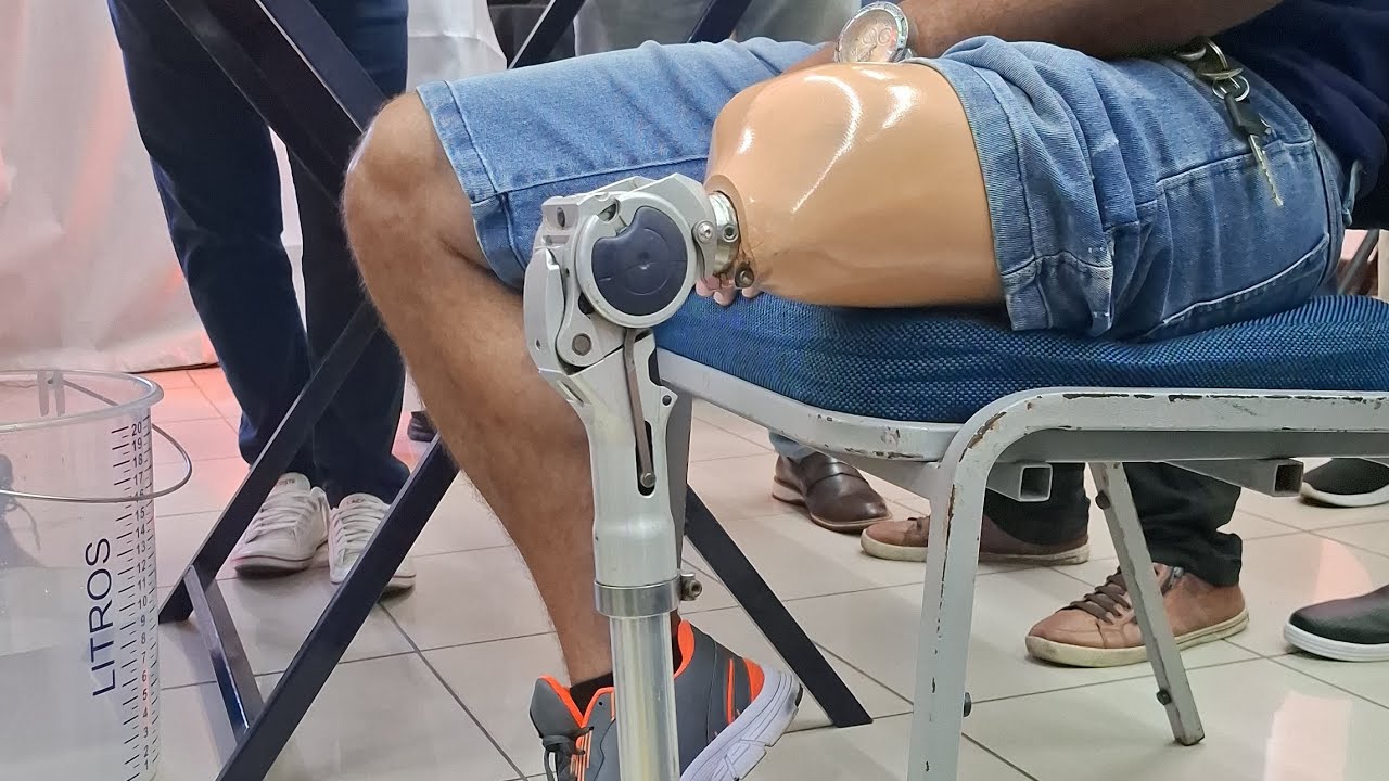 Avaliação paciente protetizado durante curso de prótese Transfemoral #amputação #fisioterapeuta 