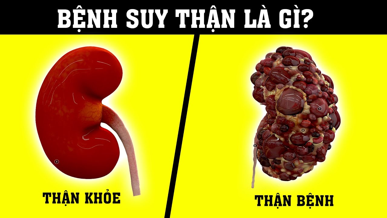 Suy thận - Chạy thận là gì? Hiểu rõ trong 5 phút