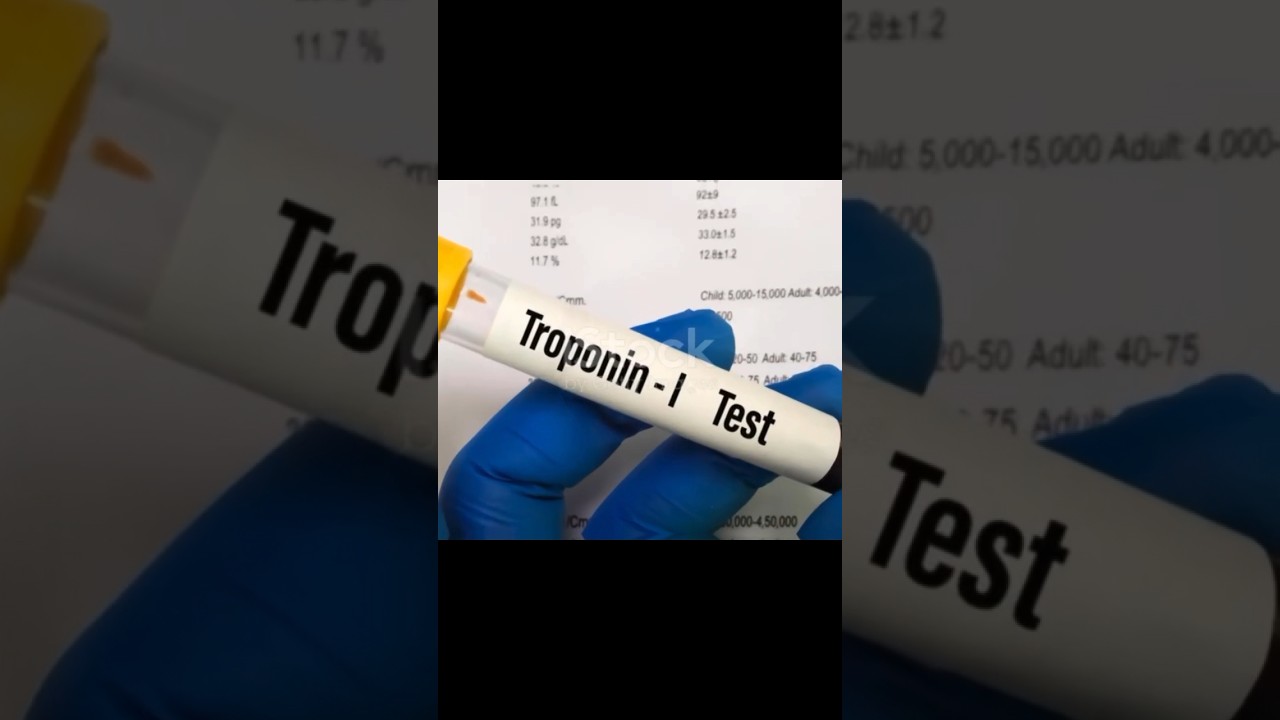 Mastering Cardiac Profiles: Troponin, Myoglobin, and C Reactive Protein Levels. 