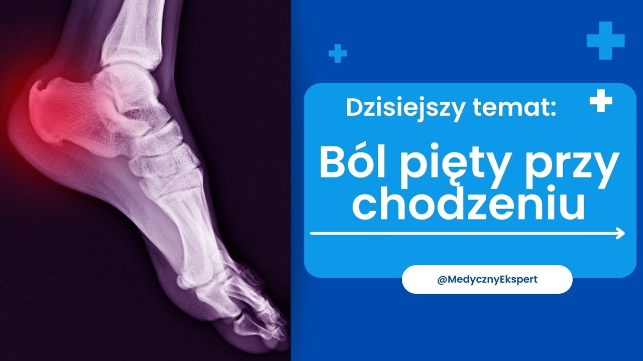 Ból pięty przy chodzeniu - przyczyny i leczenie