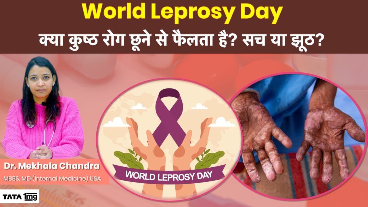 World Leprosy Day: क्या कुष्ठ रोग छूने से फैलता है? सच या झूठ? | Tata 1MG
