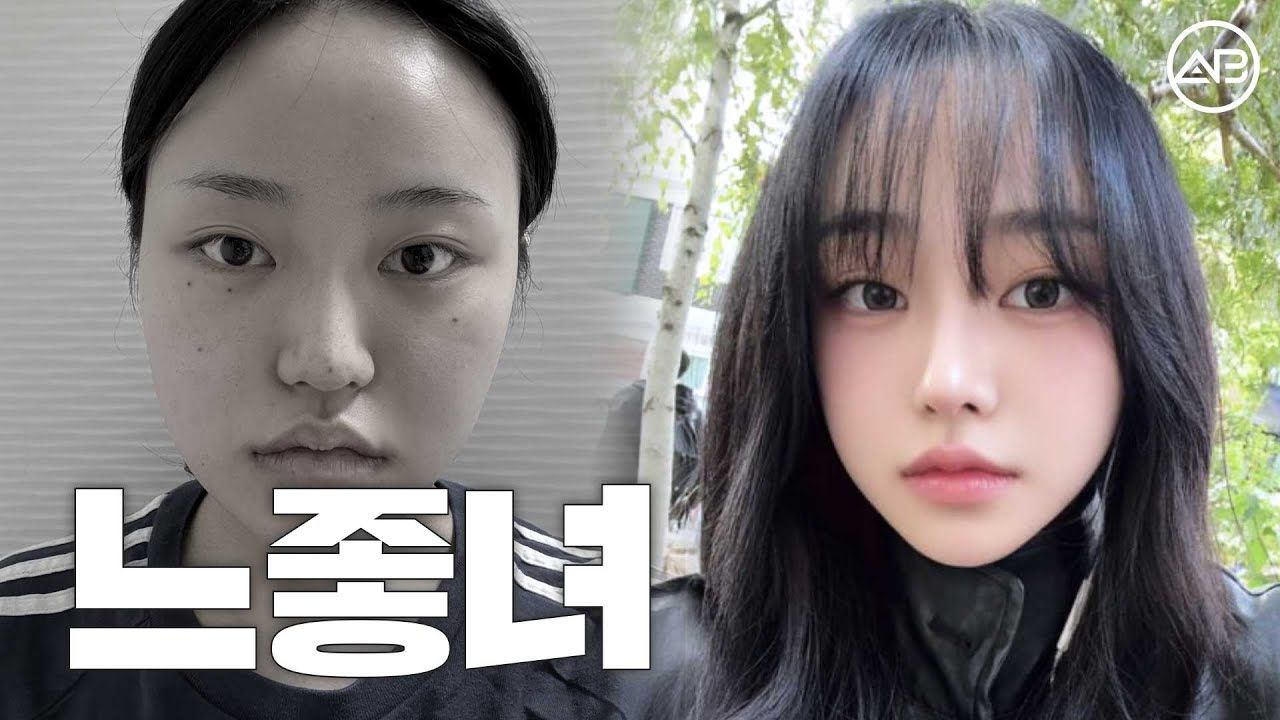 코, 윤곽하고 자연스럽게 느좋녀 되기 | 후기있음 | 에이비성형외과