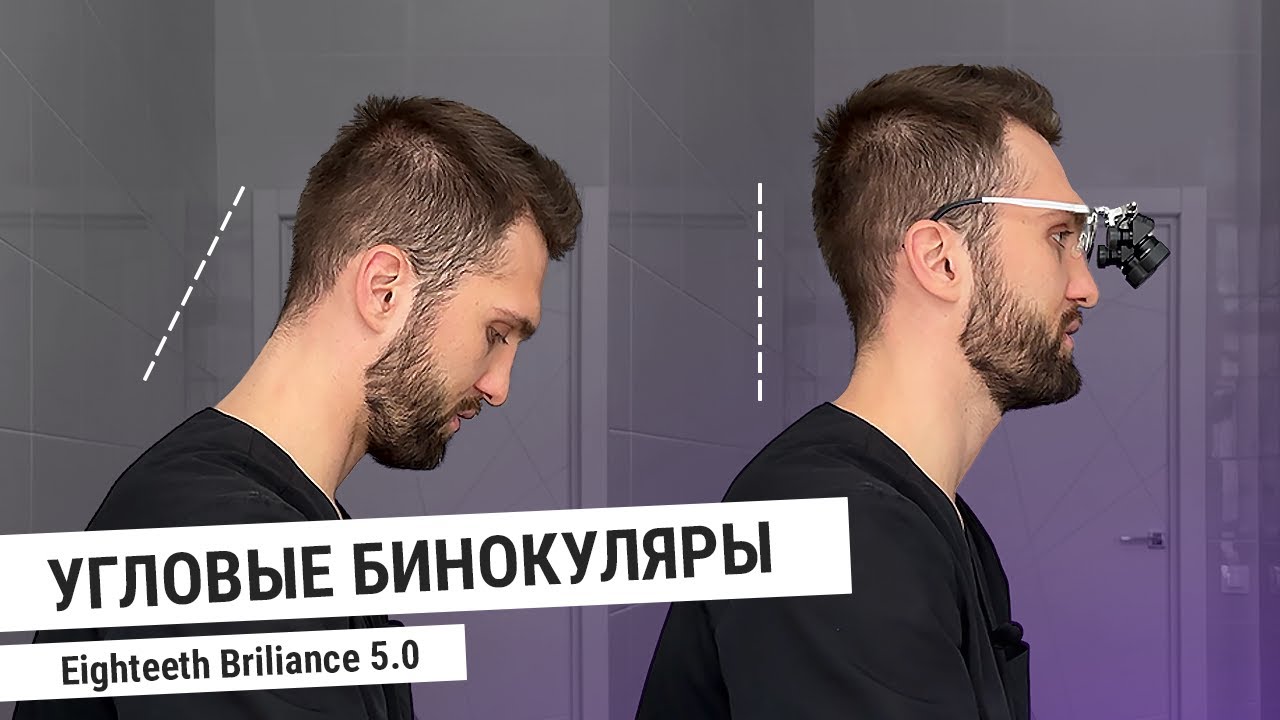 СтомОбзор №1 | Угловые бинокуляры Eighteeth Brilliance 48°