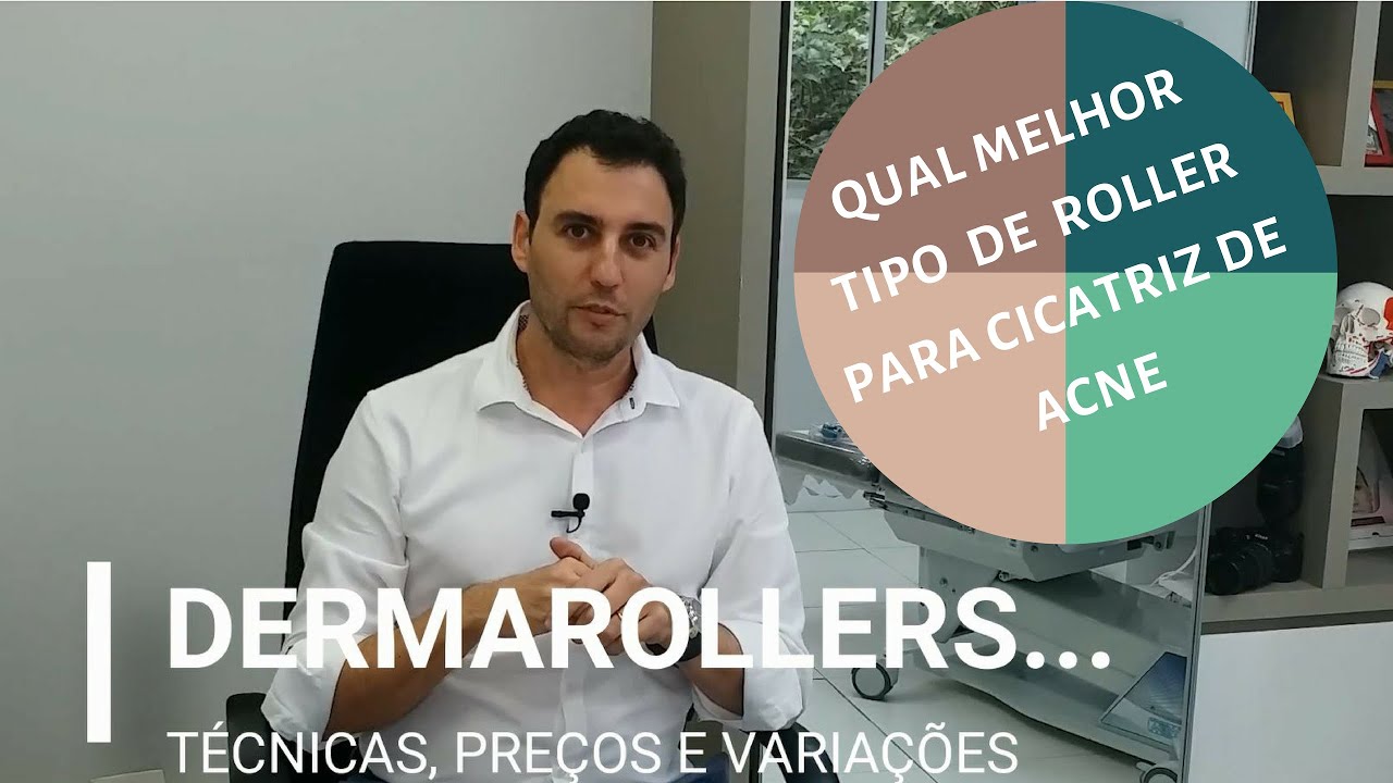A melhor forma de tratamento da cicatriz de acne :Dermaroller, microagulhamento, tunelização e  IPCA