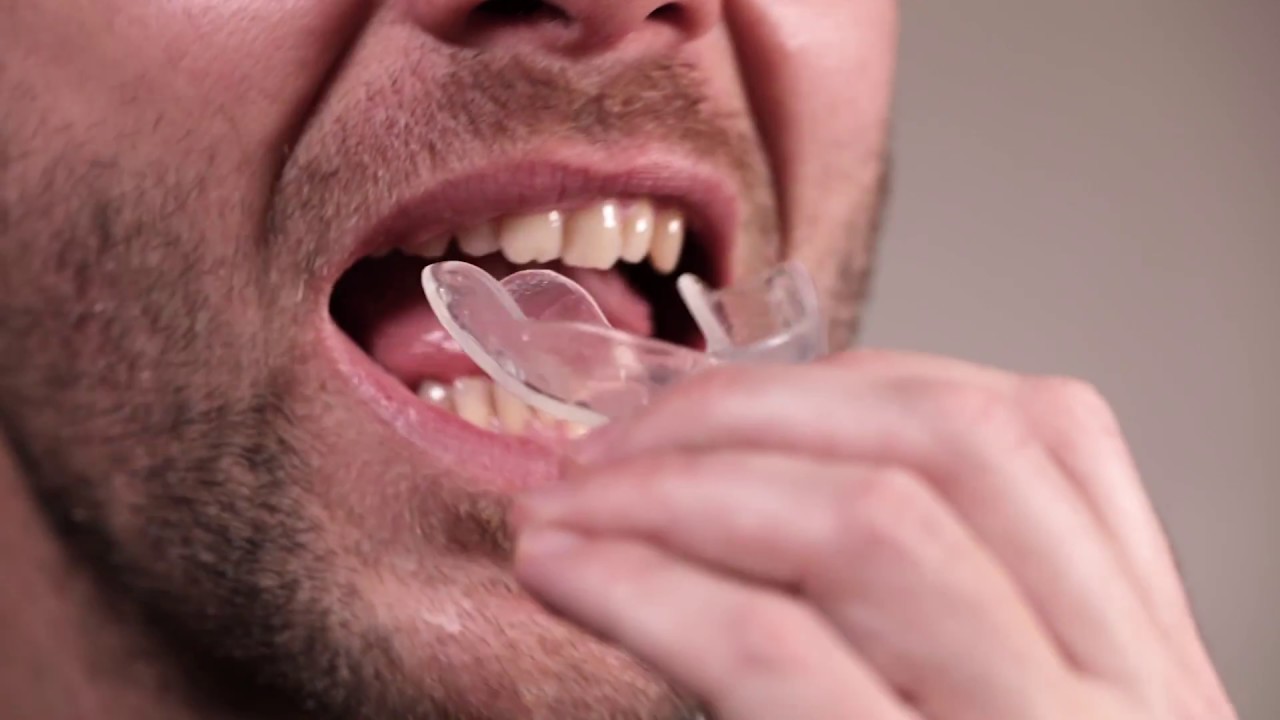 How to mold teeth whitening trays at home