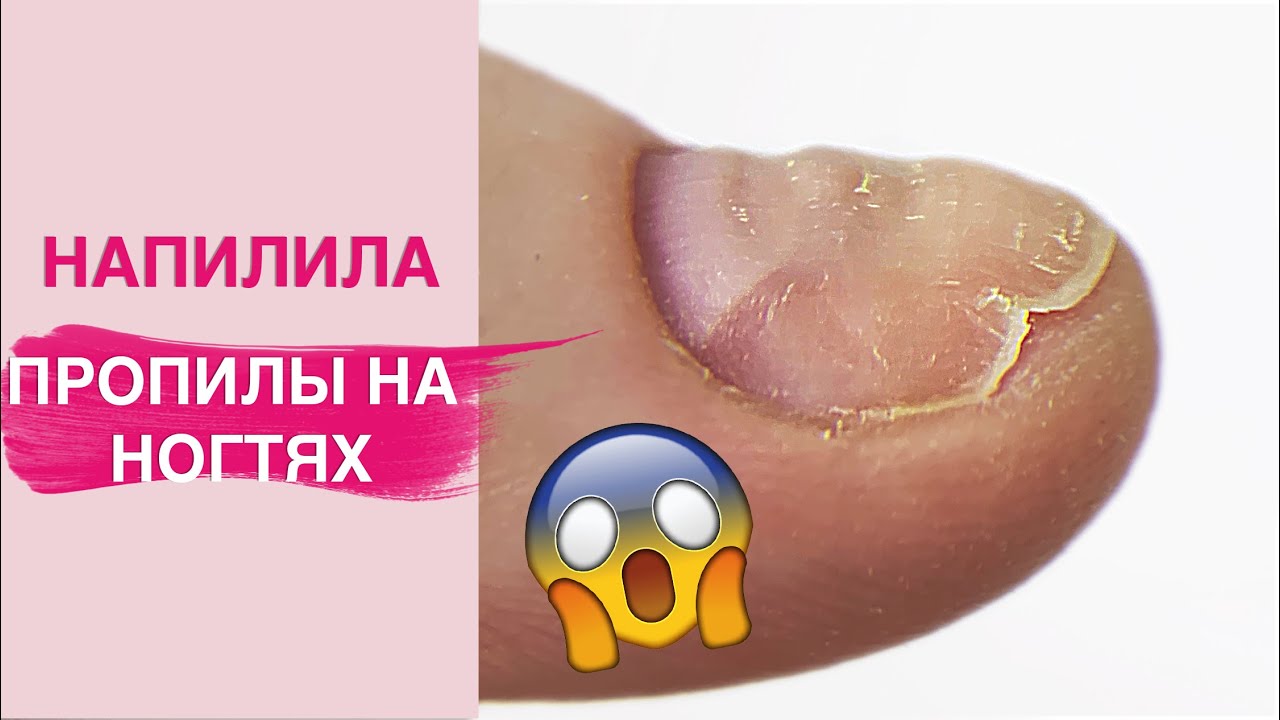 НАПИЛИЛА 🤦🏻‍♀️| Последствия Аппаратного маникюра