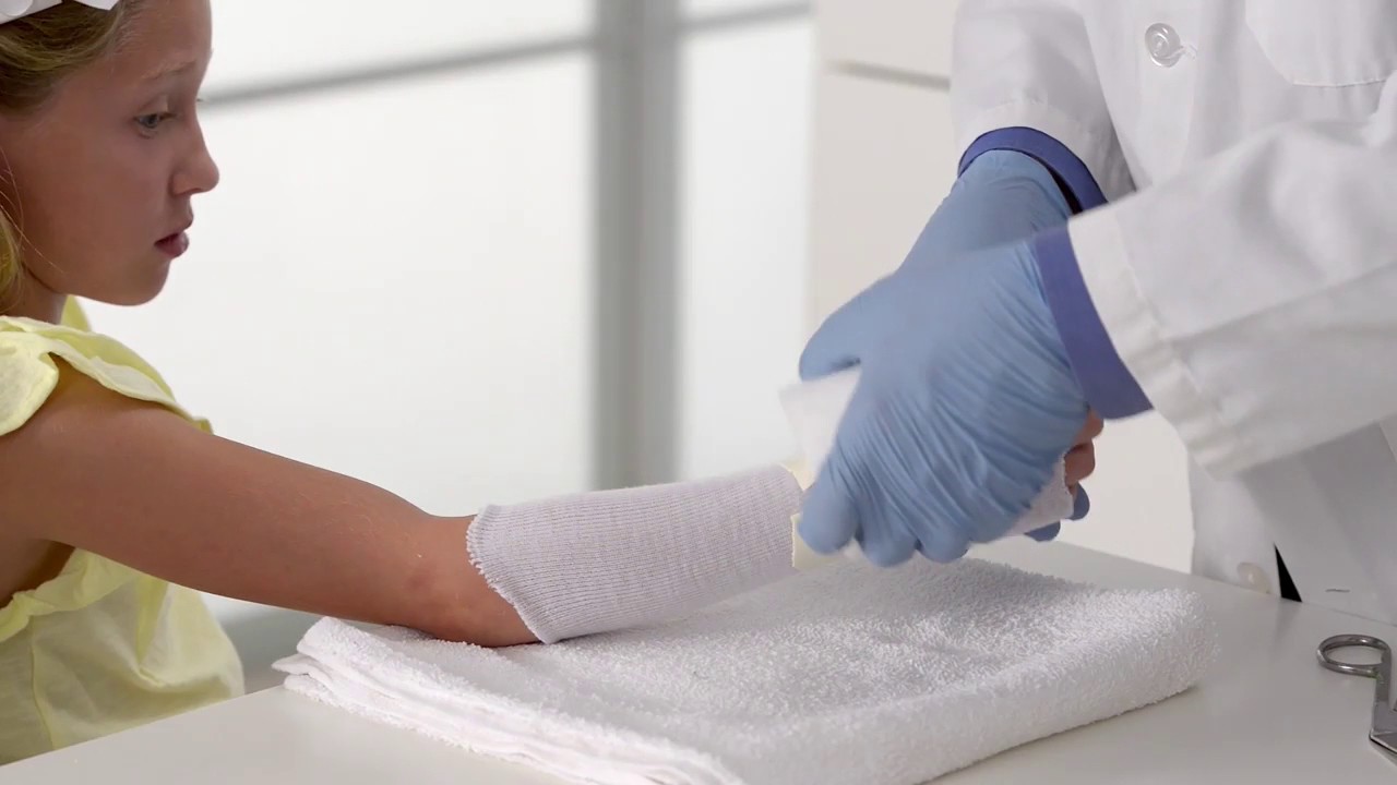 How to Apply a Thumb Spica Cast - 3M™ Scotchcast™ Soft Cast