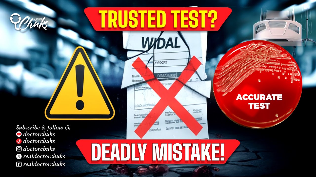 TYPHOID Tests Are WRONG 83% Of The Time