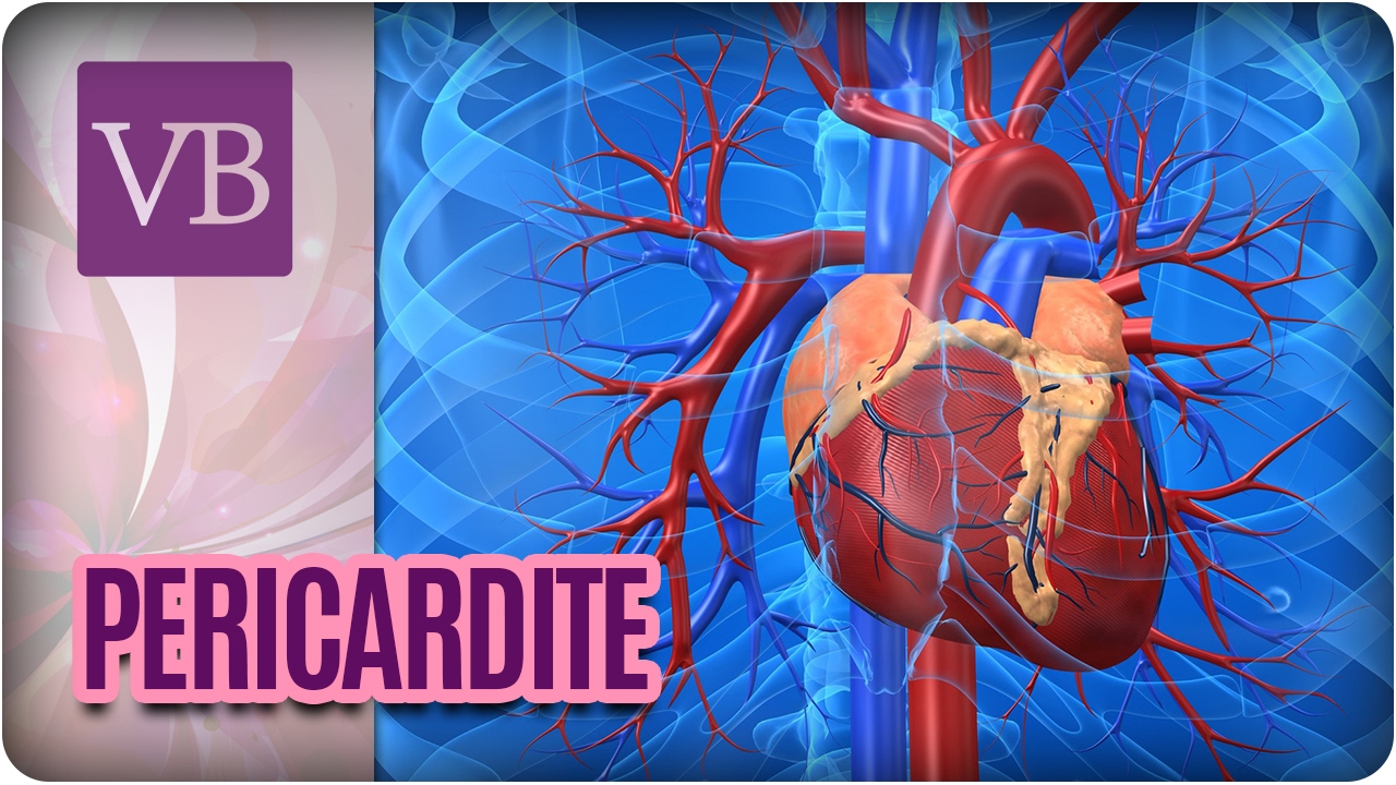 Pericardite: Inflama&ccedil;&atilde;o do Peric&aacute;rdio - Voc&ecirc; Bonita (21/02/17)