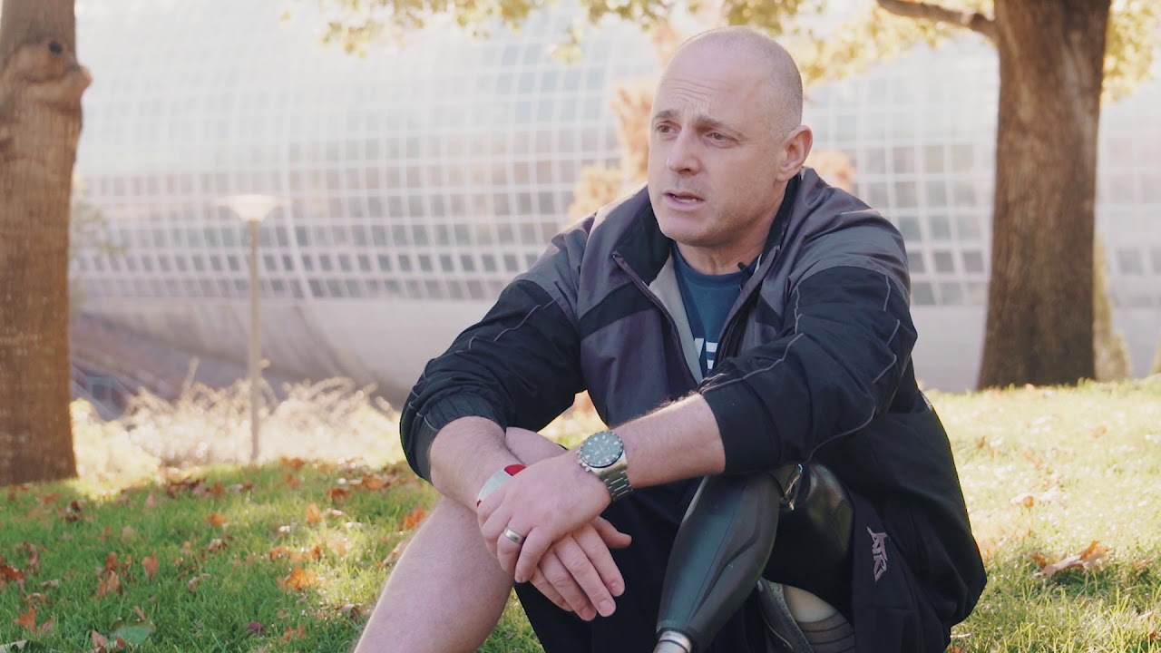 William Mathieson | Martin Bionics Clinical Care™ - Patient Stories