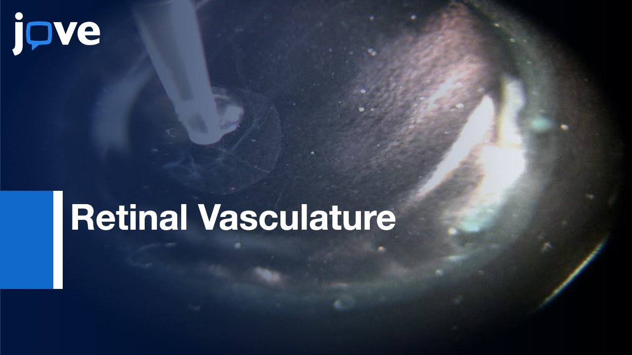 Trypsin Digest Protocol to Analyze Retinal Vasculature | Protocol Preview