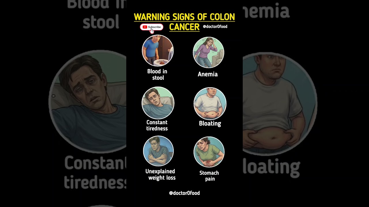Warning Signs of Colon Cancer You Should Never Ignore | Early Symptoms of Colon Cancer #healthylife