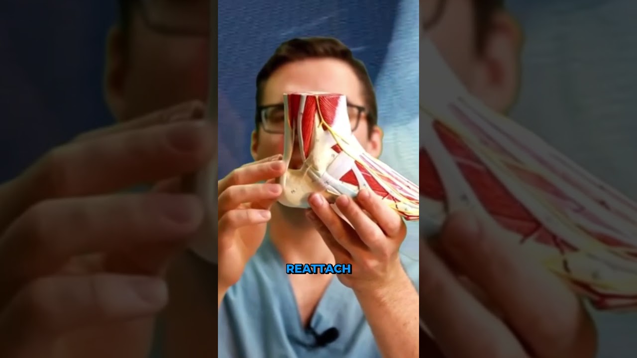 How Stretching And Cross Training Can Relieve Heel Pain [SKIP SURGERY]