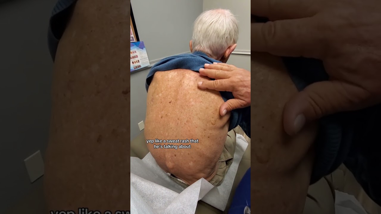 Dermatologist with 50 Years Experience Examines Patient in Clinic 👨🏻&zwj;⚕️ #dermatology  #derm