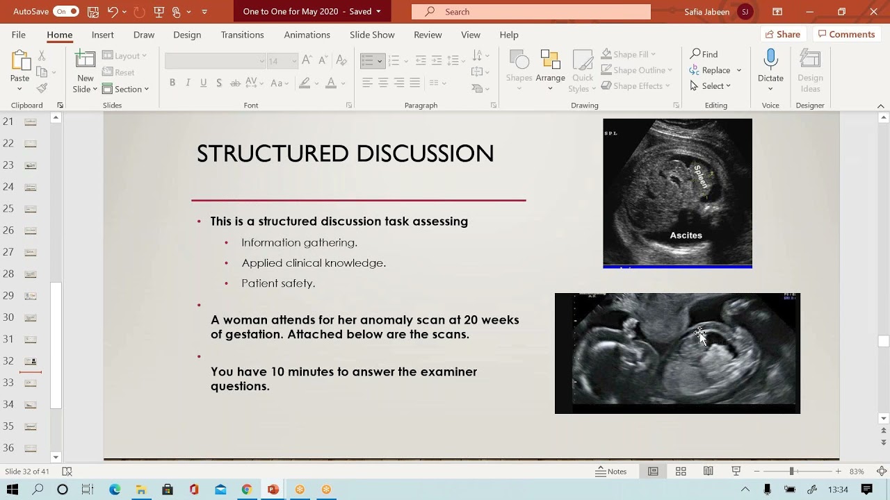 structured discussion
