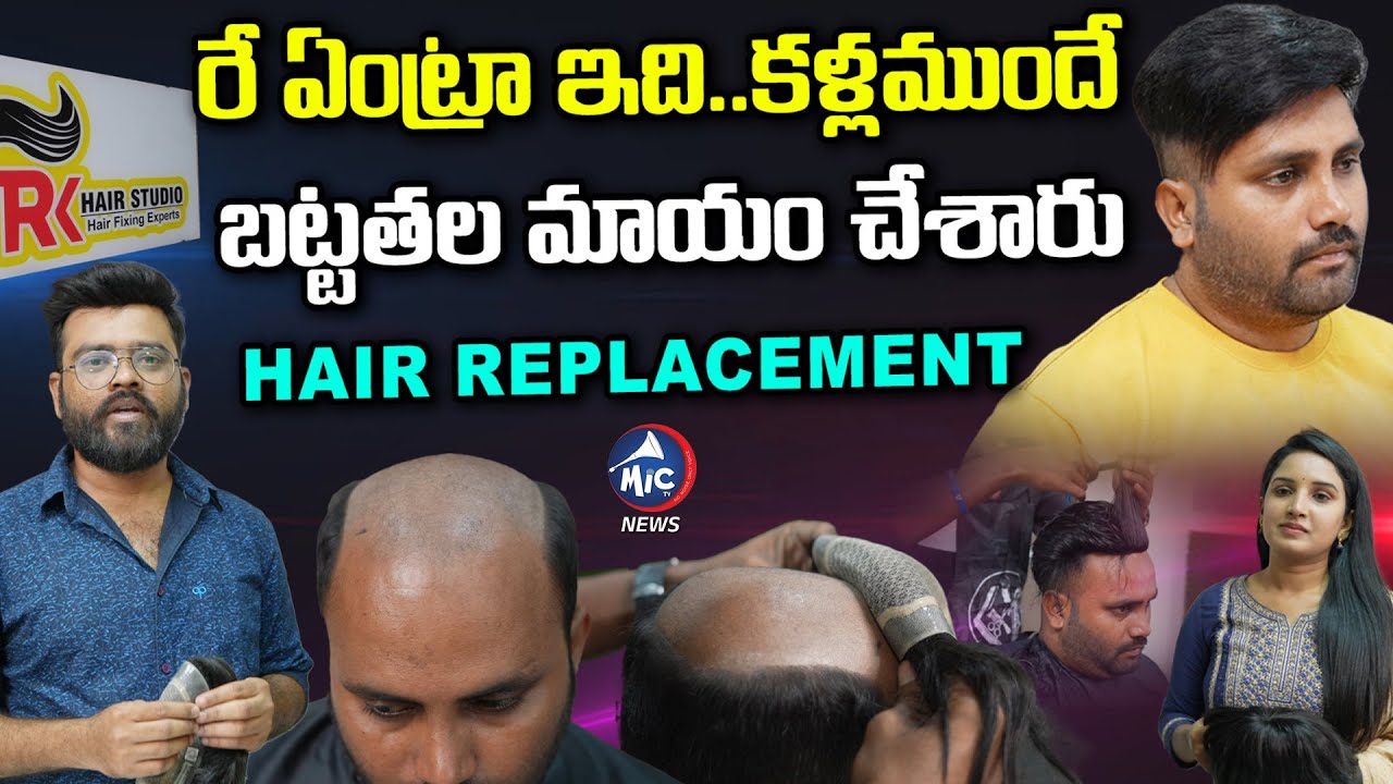 Hair Patch Fixing For Men | Non Surgical Hair Replacement | Rk Hair Studio | Mic TV News