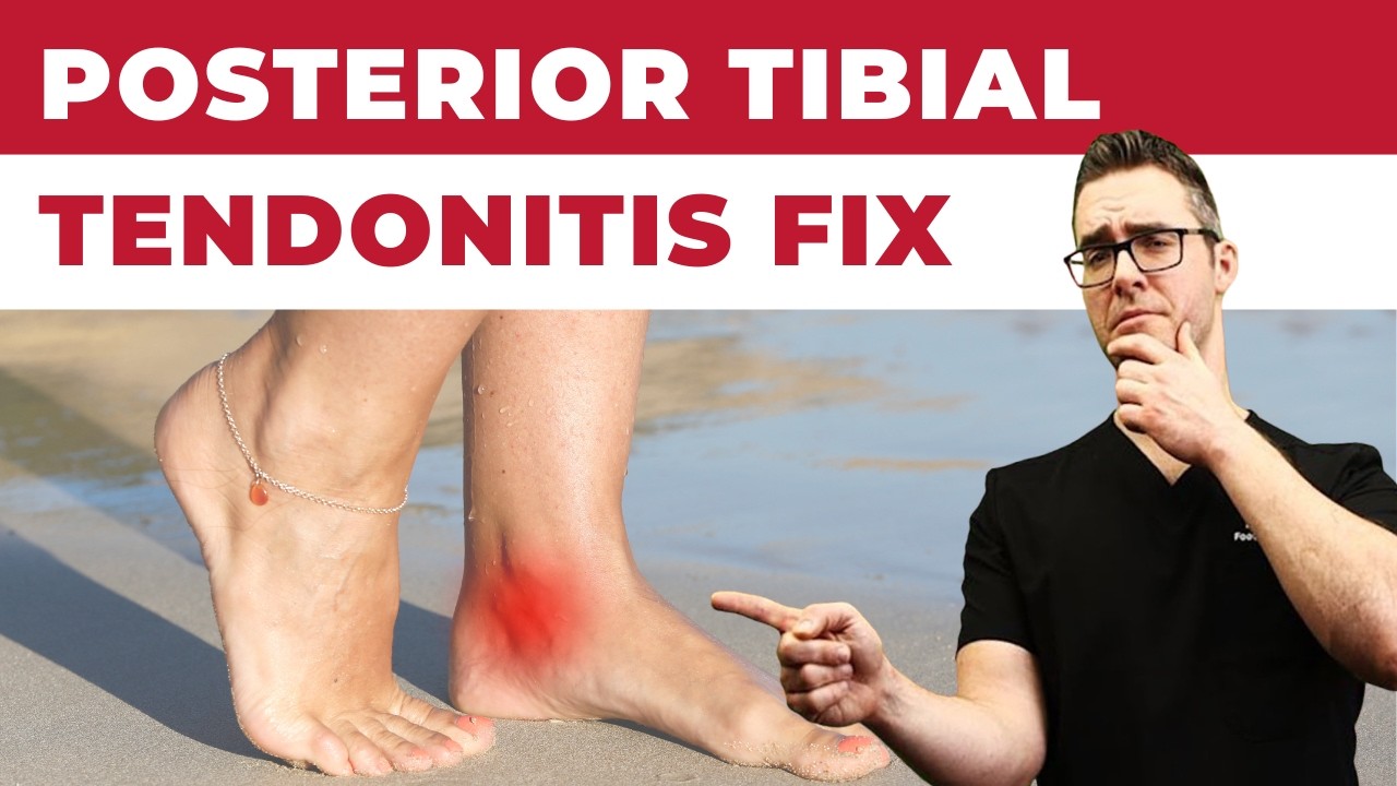 Боль внутри лодыжки [Лечение тендинита задней большеберцовой кости] 2022