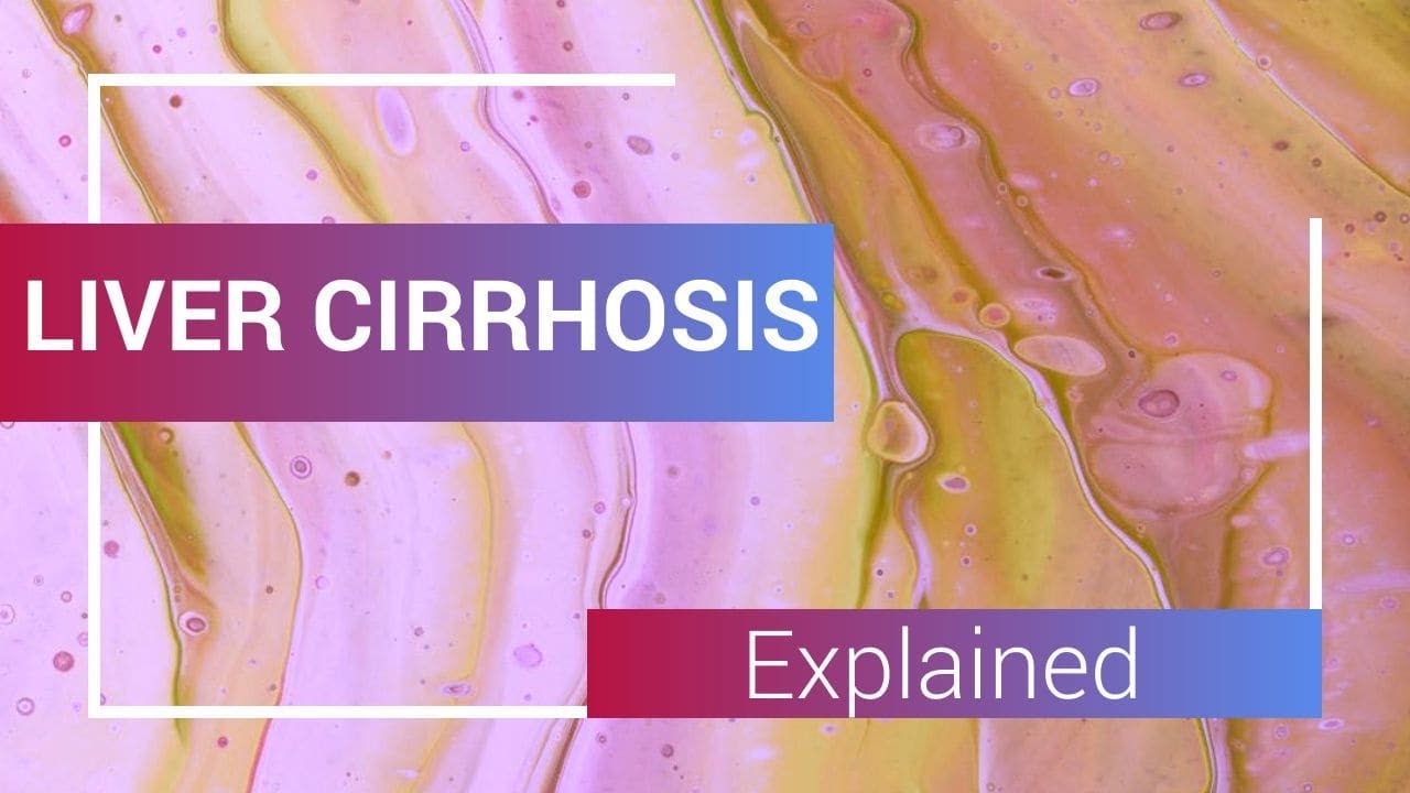 Liver Cirrhosis Explained From the Experts