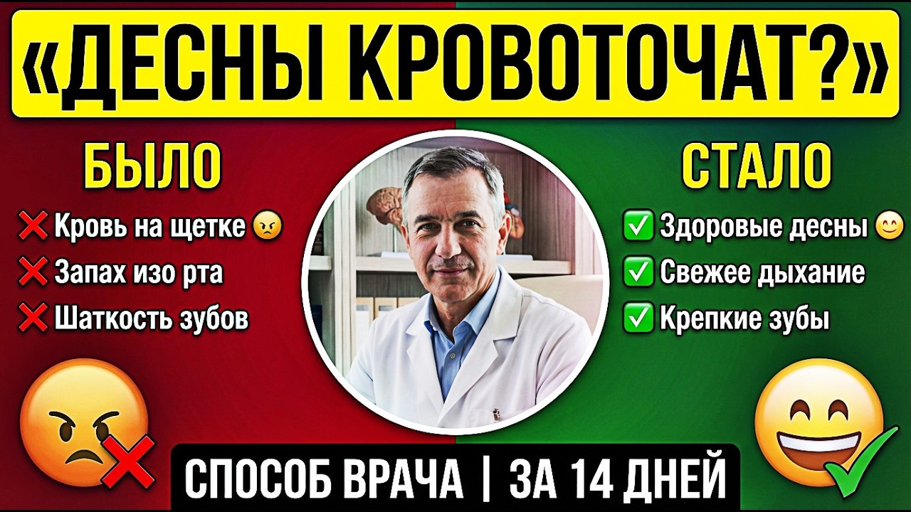 Кровоточат десны? Это Сигнал организма, который нельзя игнорировать 55+ | Врач