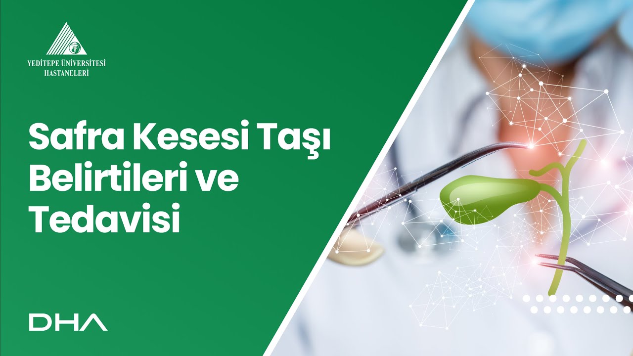 Safra Kesesi Taşı Belirtileri ve Tedavisi  / Prof. Dr. Kinyas Kartal