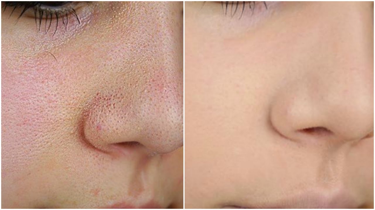 الطريقة الصحيحة لاخفاء المسام المفتوحة و شوائب البشرة نهائيا | How to Cover Up Large Pores