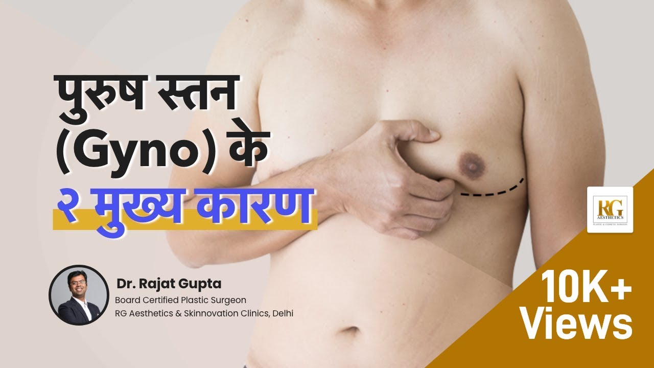 Gynecomastia Hone Ke 2 Karan | Exercise & Steroids Side Effects | Gyno/Man boobs | Dr Rajat Gupta