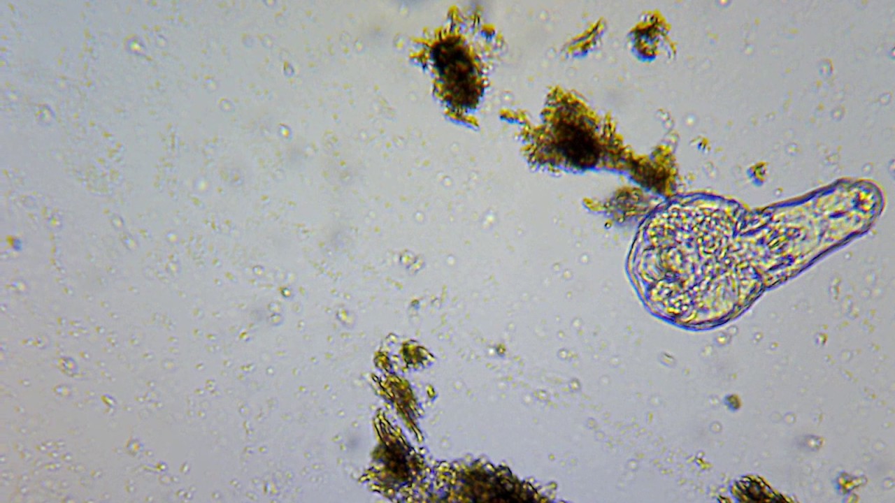 Rotifer - Wrotek - (żyjątko z doniczki storczyka-  mikroskop DeltaOptical BioLight 300