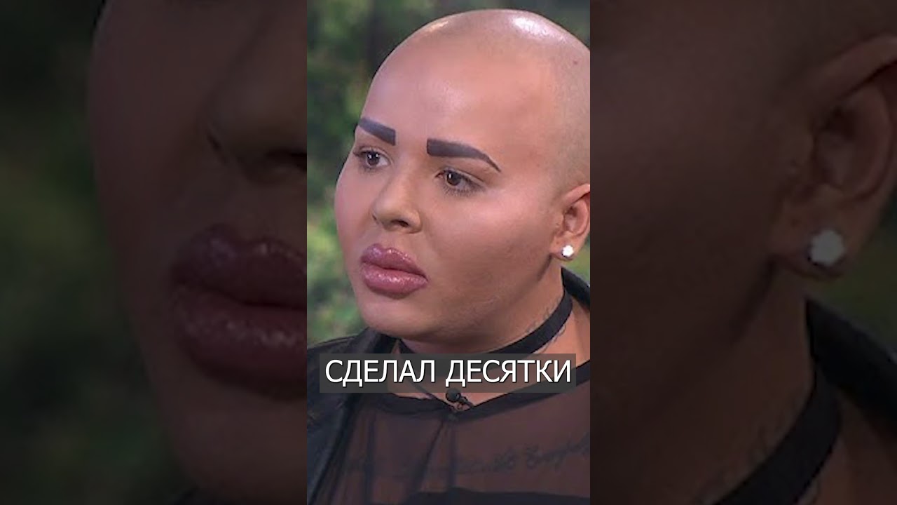 Британский КОРОЛЬ ГУБ Умер После Очередной Пластики