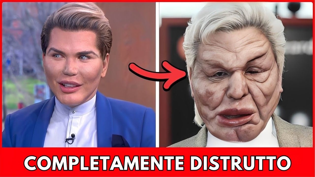 TOP 7 Persone che Hanno ESAGERATO con la Chirurgia Plastica per Assomigliare ai Loro Idoli